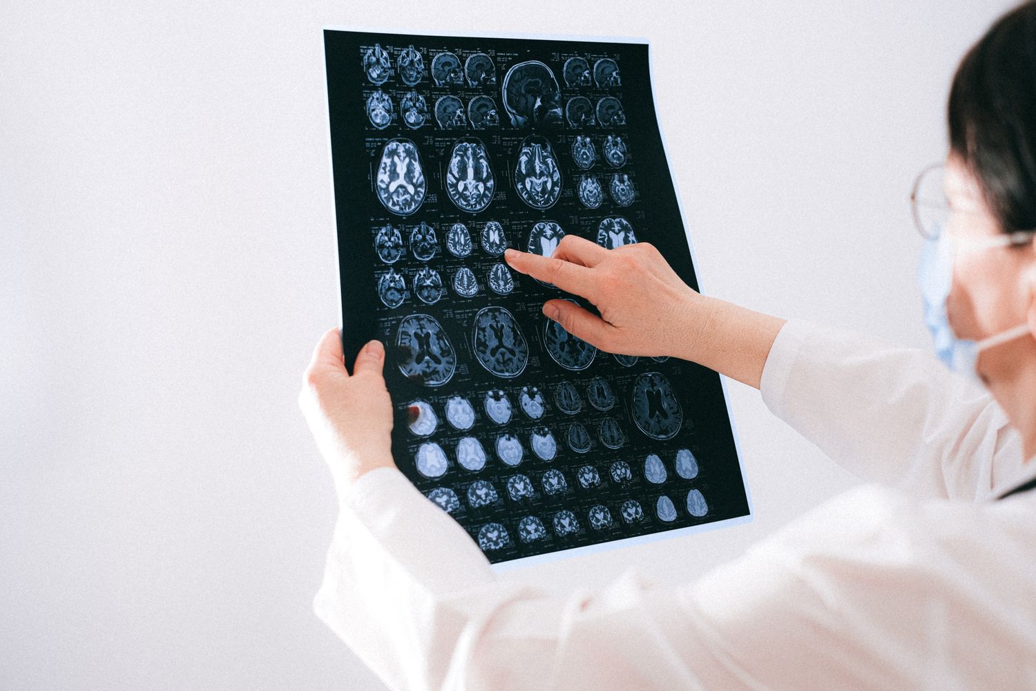 A clinician reviewing diagnostic brain imaging